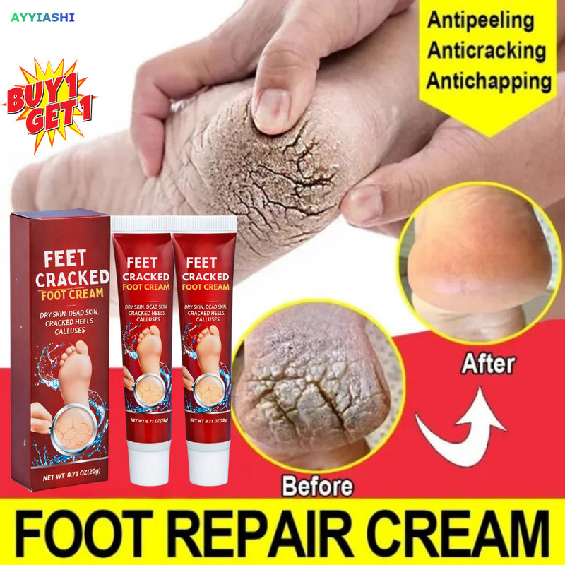 AYYIASHI Crack Cream For Men Supports Cracked Heels Treatment And Foot Routine(2 Items in the set)