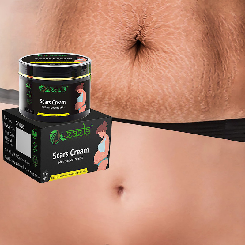 Zazla Scars Cream Stretch Mark, Ageing, Uneven Skin(100 g)