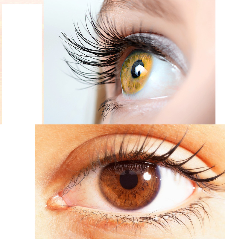 Diamond Eye Hazel, Brown Color Contact Lens 2pair & Solution For Men and Women(Pack of: 5)