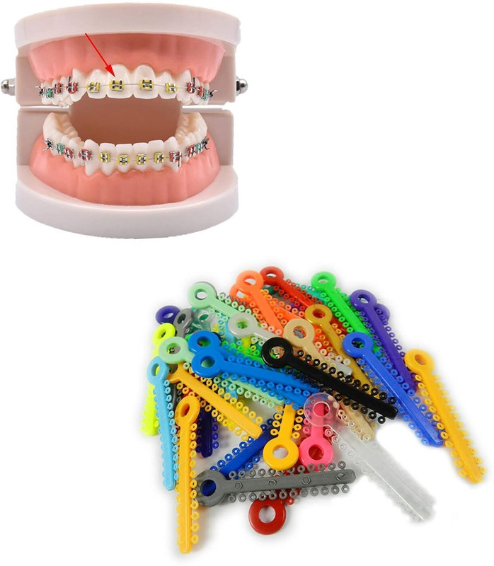 Dentosmile Orthodontics (Latex Free)Ligature Ties For Braces 1008pk in Multi Colours