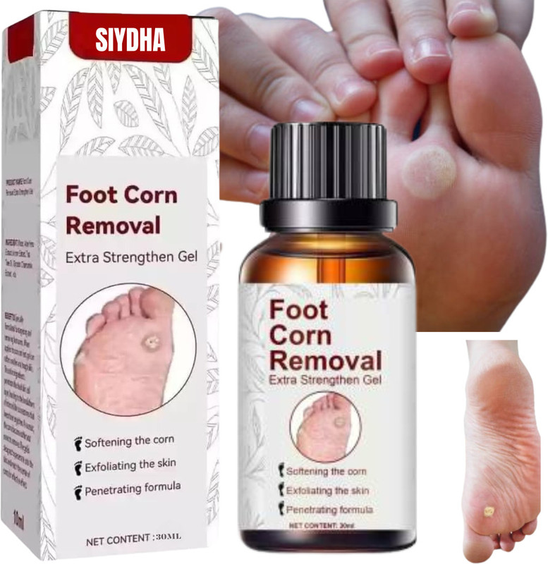 SIYDHA Foot Corn Remover Gel For Pain-free Relief