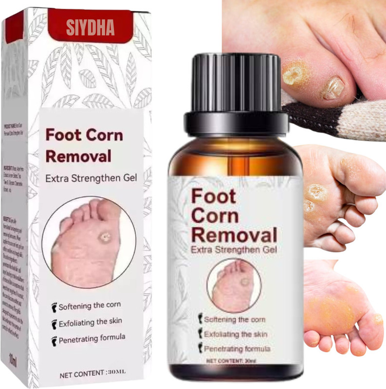 SIYDHA Foot Corn Remover Serum Fast-acting, Pain-free Corn & Callus Remover