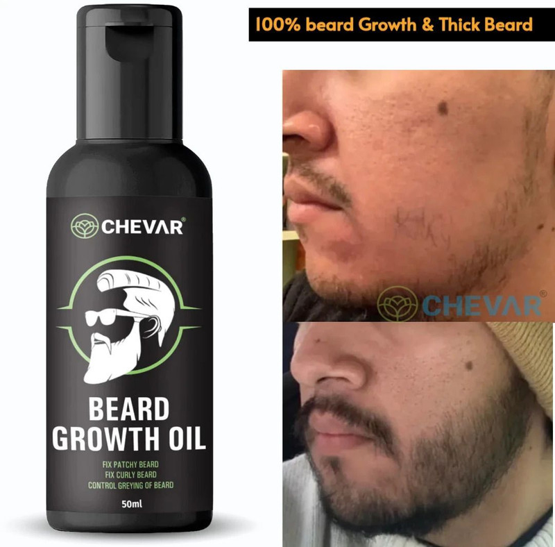 Chevar beard oil Advanced Faster Beard Growth oil with 100% Natural Ingredients Hair Oil(50 ml)