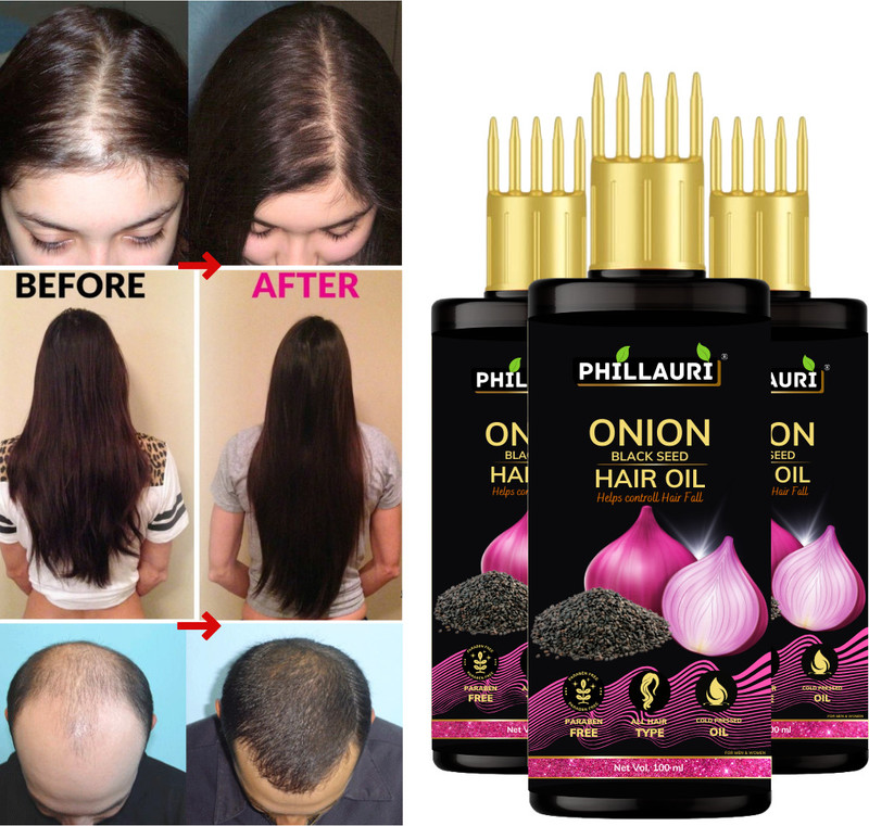 Phillauri Red Onion Hair Oil - WITH COMB APPLICATOR- Black Seed Onion Oil Hair Oil(300 ml)