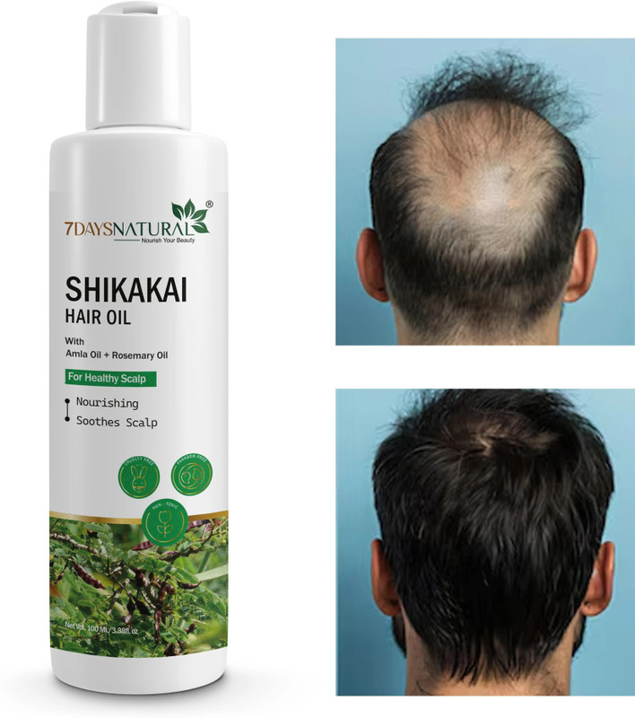 7 Days SHIKAKAI OIL - 100 ML Hair Oil(100 ml)