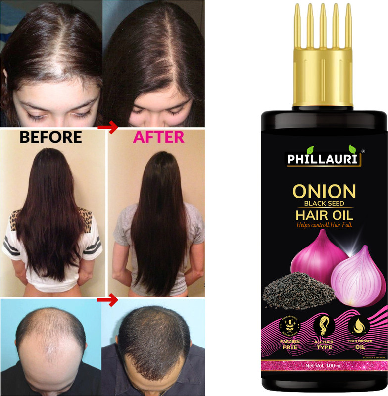 Phillauri Onion Hair Oil With Black Seed Oil Extracts - Controls Hair Fall 100ml Hair Oil(100 ml)