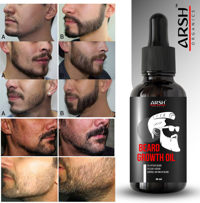 Arsh Organics "Prime Growth: Fuel Your Beard's Potential with our Beard Oil" Hair Oil(30 ml)