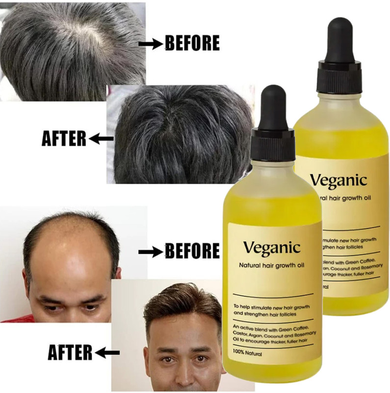 Veganic Natural Hair growth oil for Stress Relief Weak Hair Hair Oil(120 ml)