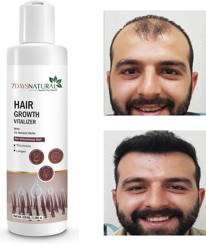 7days natural Hair Growth Vitalizer for Thickerand Healthier Hair(100 ml)