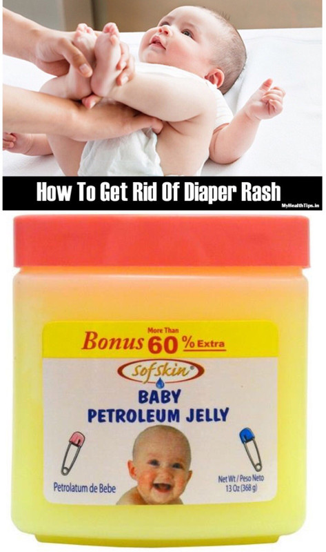 Sofskin Baby Petroleum Jelly (Anti Diaper Rash) 368 gm(368 g)
