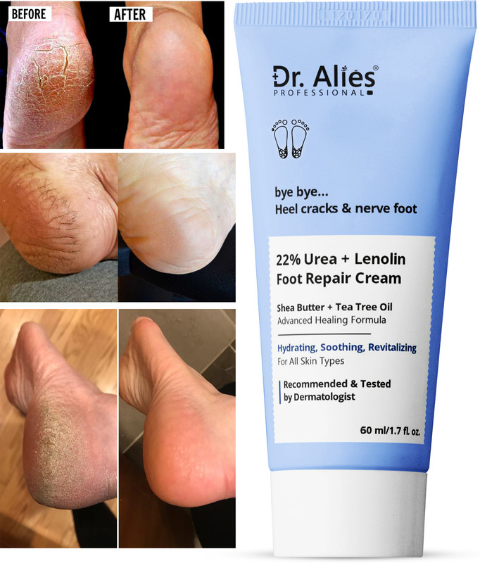 Dr. Alies Professional 22% Urea with Lenolin Foot care cream for Dry & Cracked Feet, crack heel cream(60 ml)