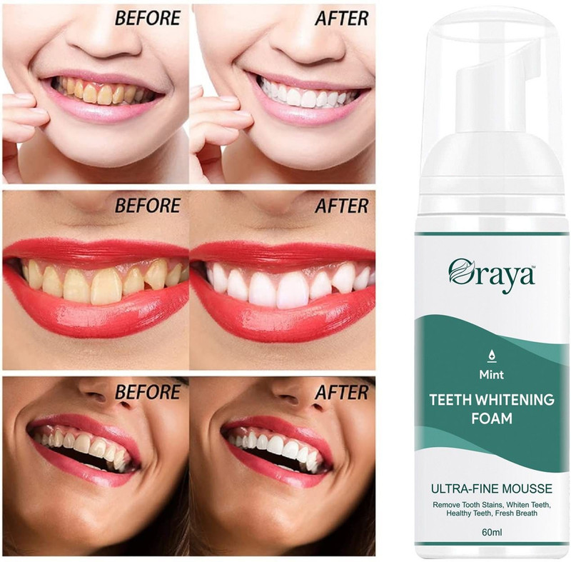 Oraya Teeth Cleansing Mousse Foam ,Deeply Cleans, Fights Bad Breath- - Mint(60 ml)
