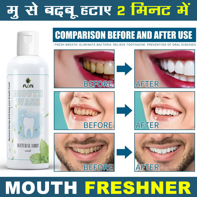 floni White -Fresh Mint Instant Mouthwash Teeth Whitening liquid Mint 100 ml - MINT, FRESH, REFRESHMENT, premium natural, cool mint(100 ml)