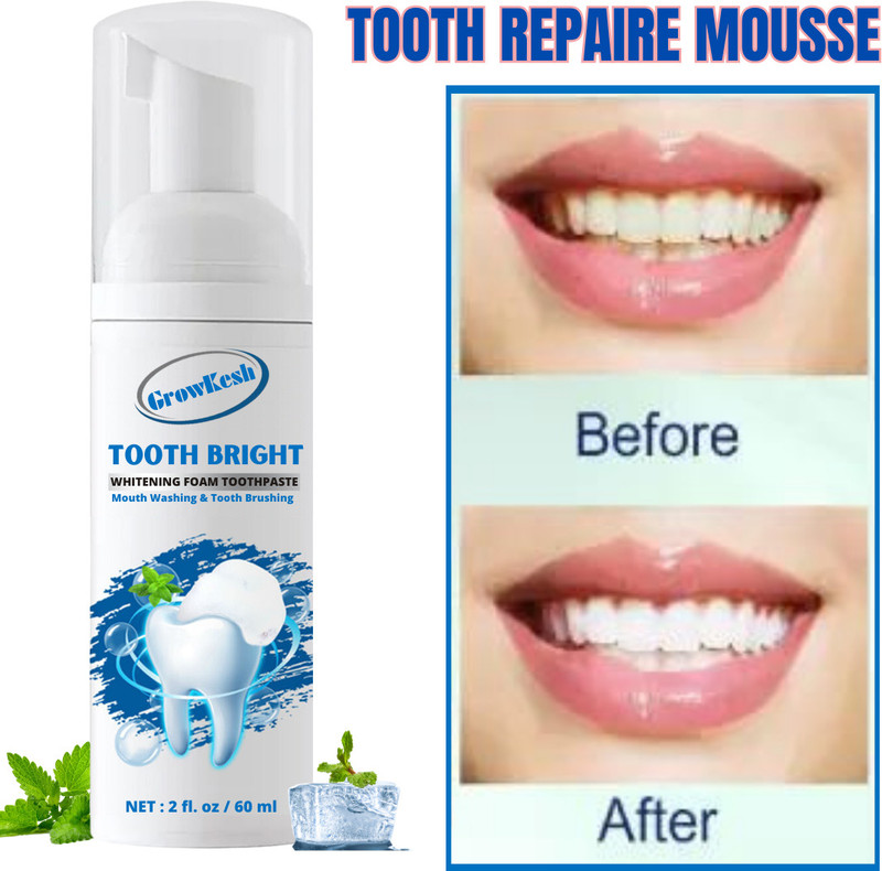 Growkesh Teeth Whitening Foam to Ultra-fine Deeply Clean Gums Intensive Stain Removal - Mint(60 ml)