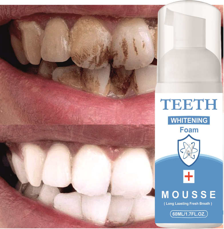 REGLET Teeth Whitening Clean Foam Gums Intensive Stain Removal Mouthwash - Mint(60 ml)