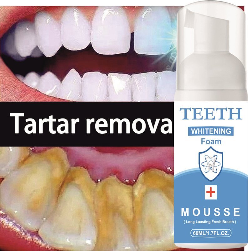 REGLET Dream White -Fresh Mint Instant Mouthwash Teeth Whitening Foam - Mint(60 ml)