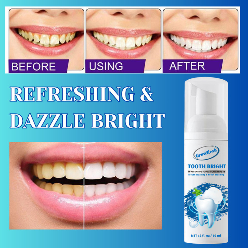 Growkesh Effervescent Smile, Teeth Whitening Foam for Radiant Results - Mint(60 ml)