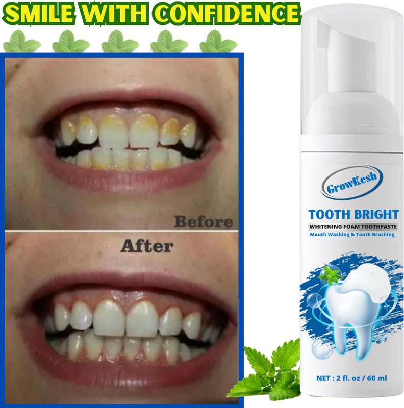 Growkesh Teeth Whitening Foam To Removes Bad Breath Fights Germs - Mint(60 ml)