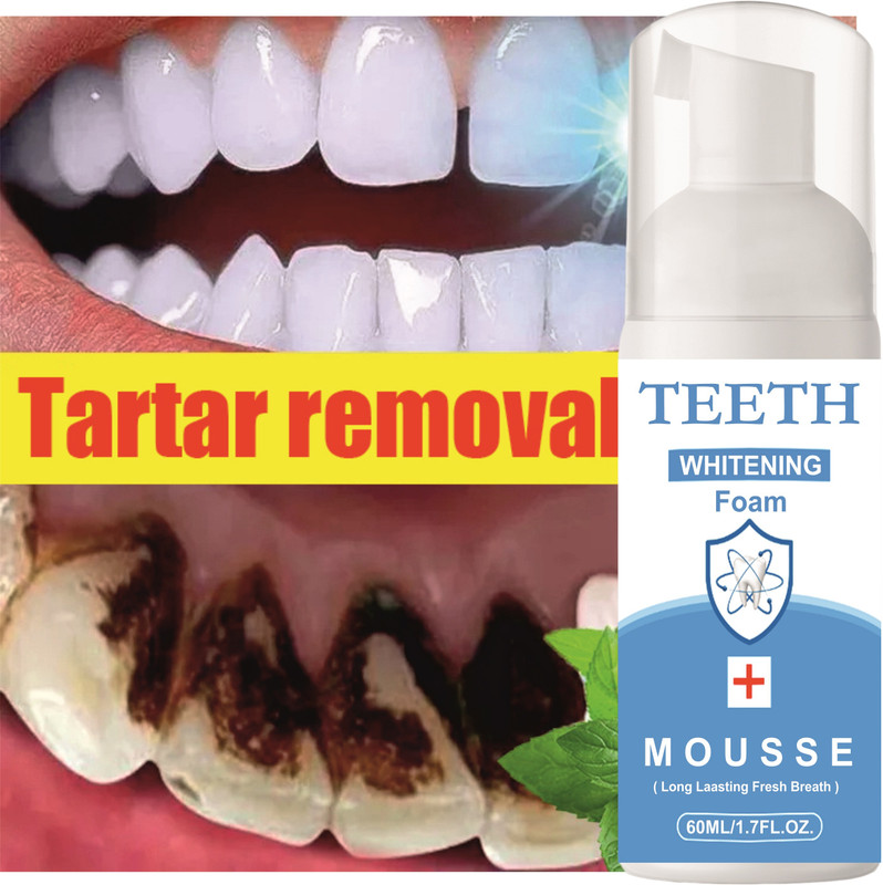 REGLET Teeth Whitening For Cold Mint freshness Effect Mouthwash - Mint(60 ml)