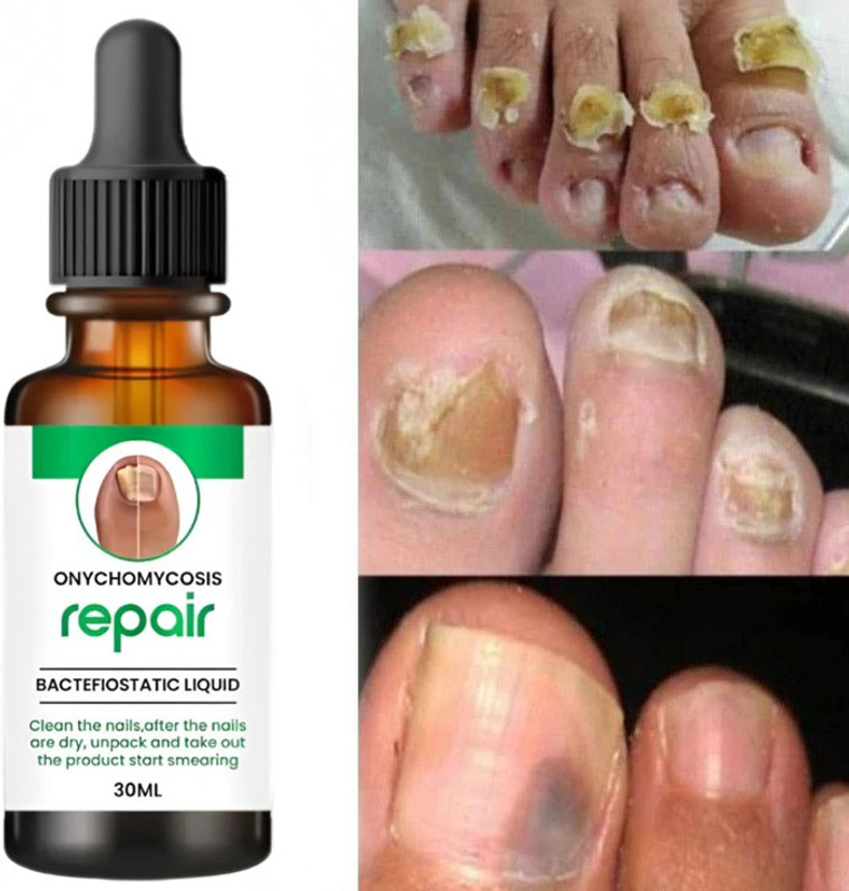 PANARO Professional Nail Repair Serum Helps strengthen breaking nails clear
