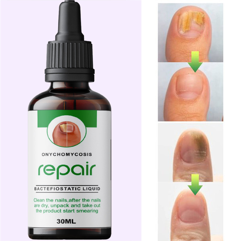 Edith 100% Natural Nails Strong Oil For Cuticle Care, Nail Growth & Strength 30 ml Corded Nailer(1 gauge)