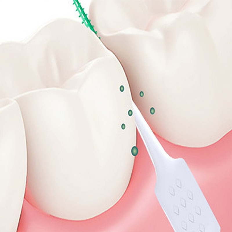 Dev Single-Use Micro Applicator Sticks Pet Toothbrush(Dental Interdental)
