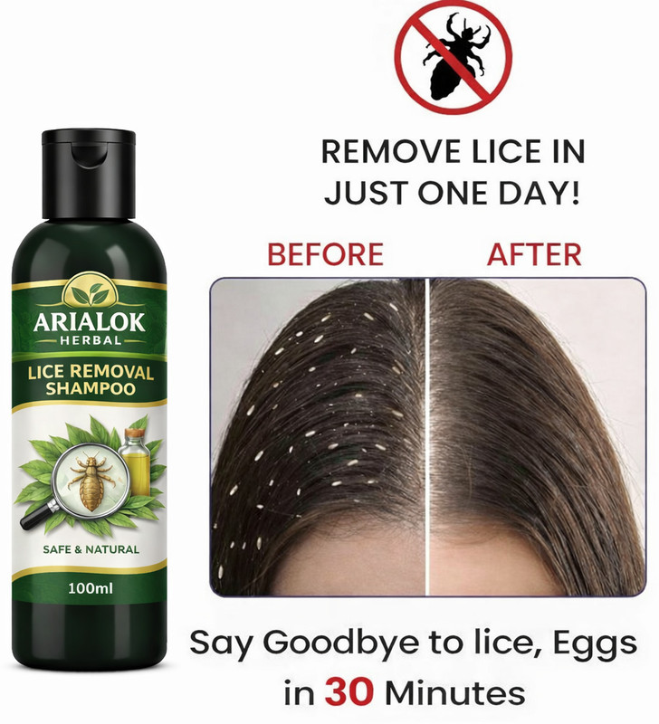 ARIALOK Natural Lice Killer Shampoo,(100 ml)