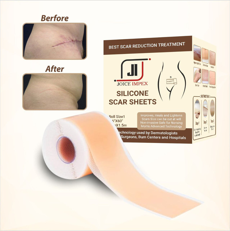 JOICE IMPEX Scaraway Silicone Scar Sheets Flesh Color Silicone Scar Remover Sheets Crepe Bandage