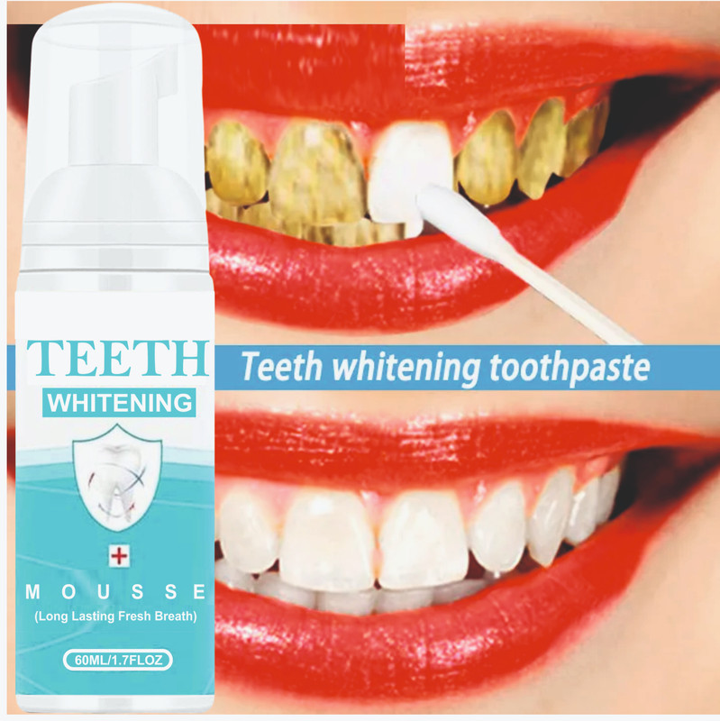 Afflatus Teeth Whitening Liquid New To Removes Bad Breath Fights Germs Teeth Whitening liquid(60 ml)