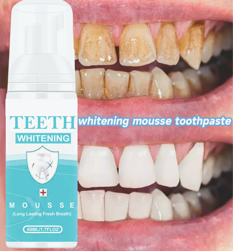 REGLET Teeth Whitening Foam To Remove Yellow Stains, Tobacoo, Tartar and Tobacco Stains Teeth Whitening liquid(60 ml)
