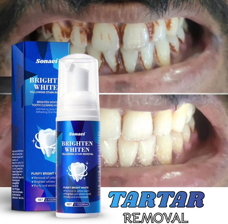 Sonavi Teeth Whitening Foam Toothpaste for Germs Killer & Whiten Teeth for Men & Women Teeth Whitening liquid(60 ml)