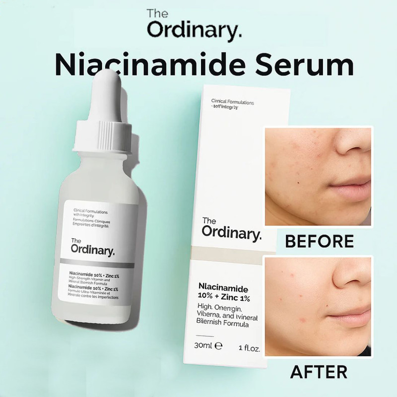 ANUA the Ordinary Niacinamide 10% + Zinc 1% Serum for a smoother appearance and brightening(30 ml)