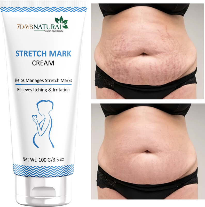7days natural Stretch Marks Removal Cream for Women Men 100% Natural Ayurvedic Cream Intimate Cream(100 g)
