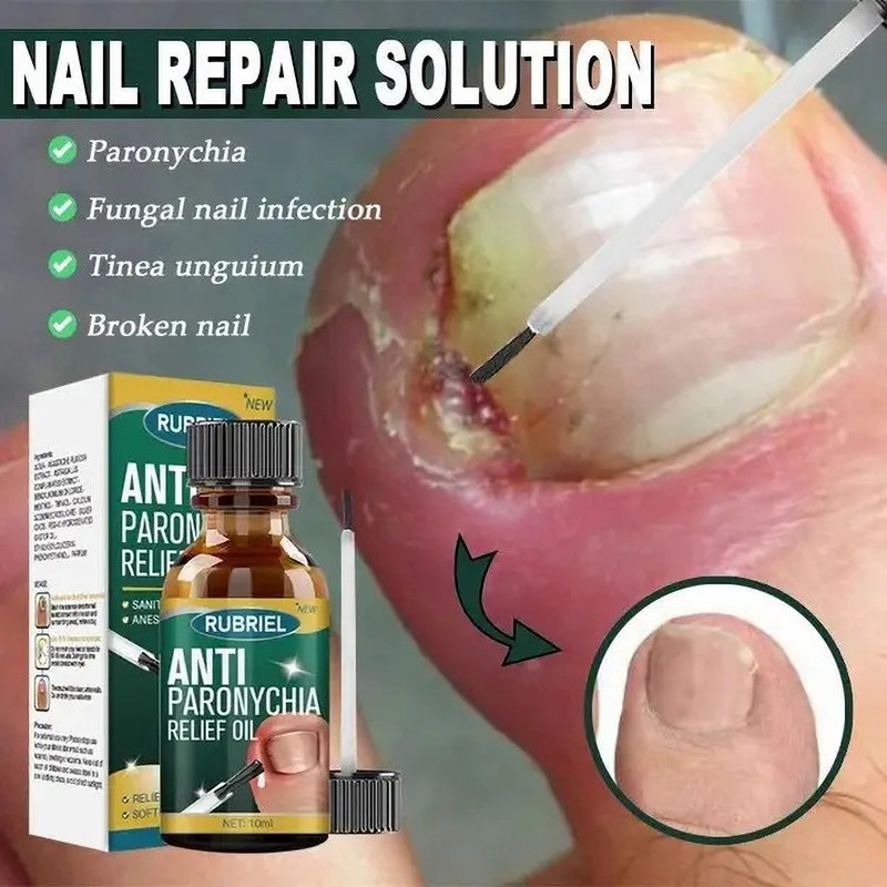 loviton Anti Paronychia Relief Oil For Strengthens Nail Barrier And Fungal Defense(30 ml)