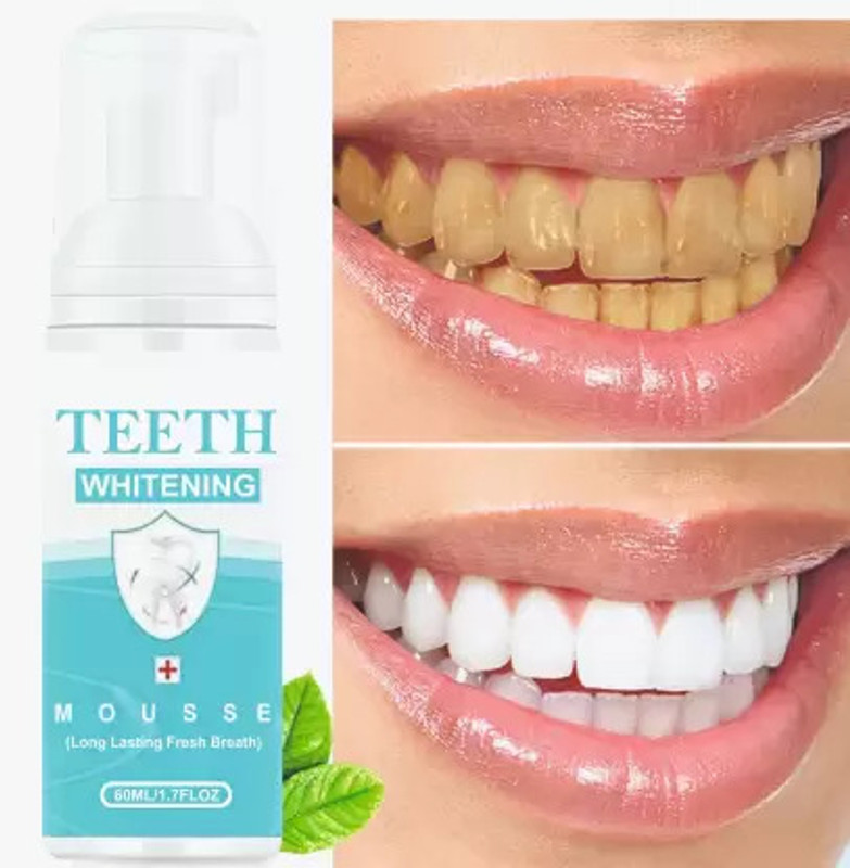 Prifakt Teeth whitening mousse toothpaste Remove Tartar Remove Bright Teeth Teeth Whitening Kit