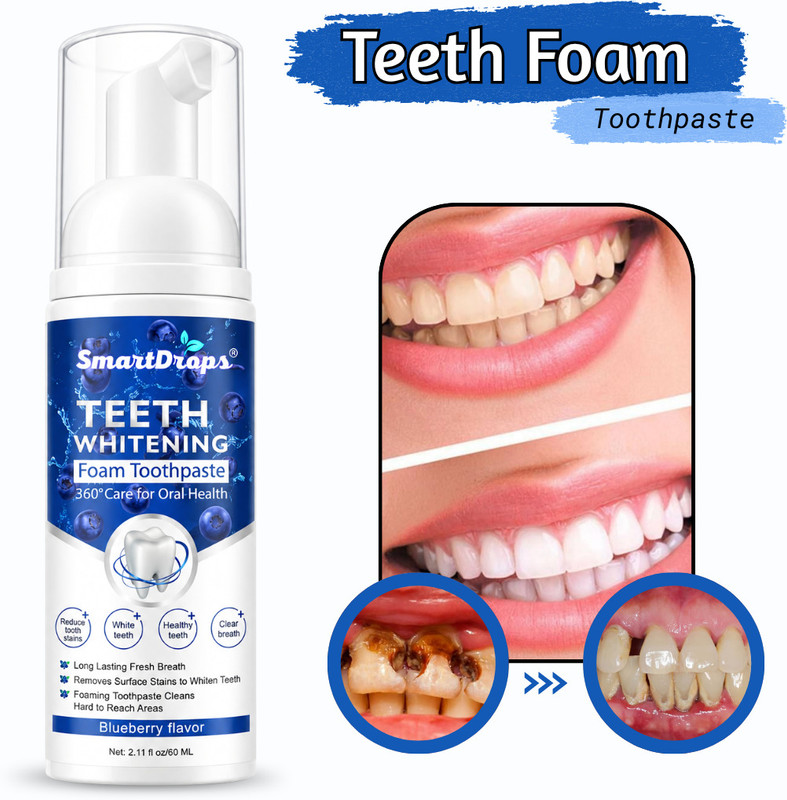 smartdrops SD_TTEETH_FOAM_60_PCKCA1 Teeth Whitening Kit