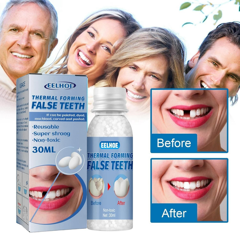 LILY GLOW Tooth Repair Kit, Temporary Fake Teeth Replacement Kit for Temporary Restoration Teeth Whitening Kit