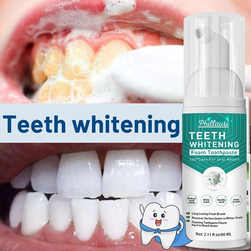 Phillauri Whitening Teeth Foam for a Radiant Smile 60ml Teeth Whitening Kit