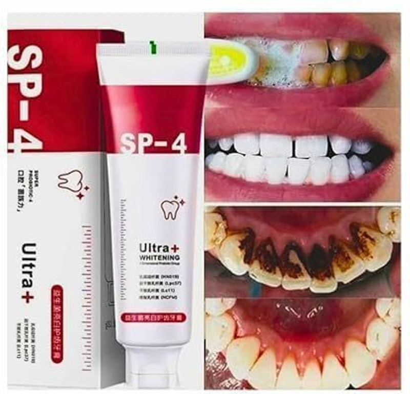Orlisse SLS-0001 Teeth Whitening Kit