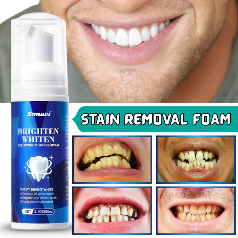 Sthetik Teeth Whitening For Mint Cold freshness Effect Liquid Foam Teeth Whitening Kit