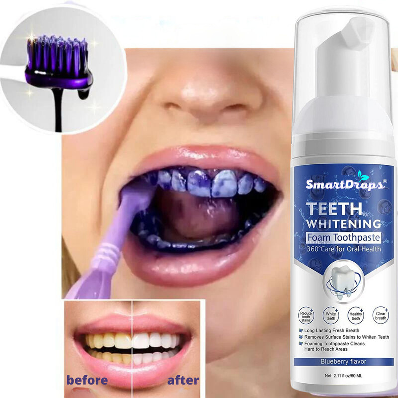 smartdrops Advanced Teeth Cleansing Foam for Fresh Smile Teeth Whitening Kit