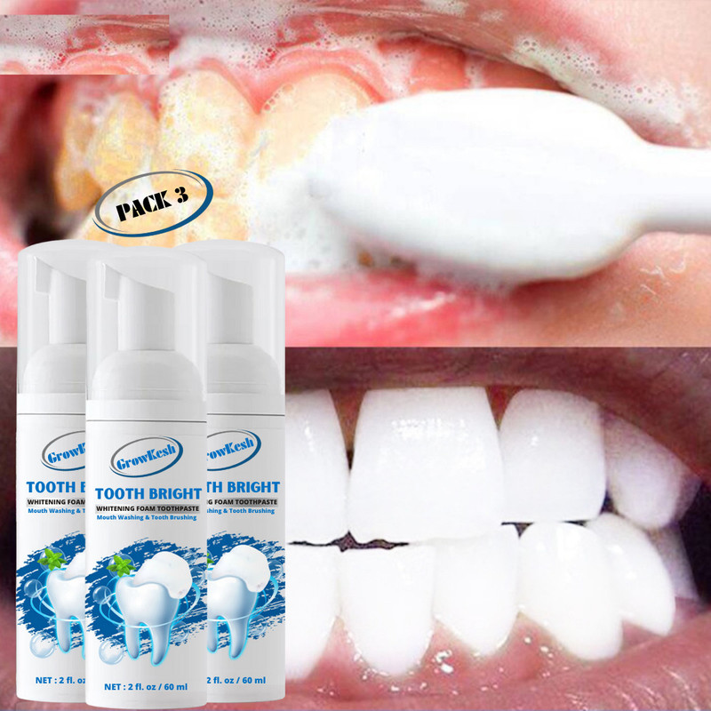 Growkesh Teeth Whitening Yellowing of Teeth Foam Teeth Whitening Kit