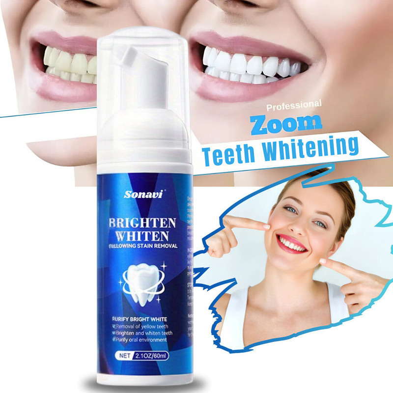 Sonavi Teeth Whitening Liquid Foam for Man & Woman Teeth Whitening Kit