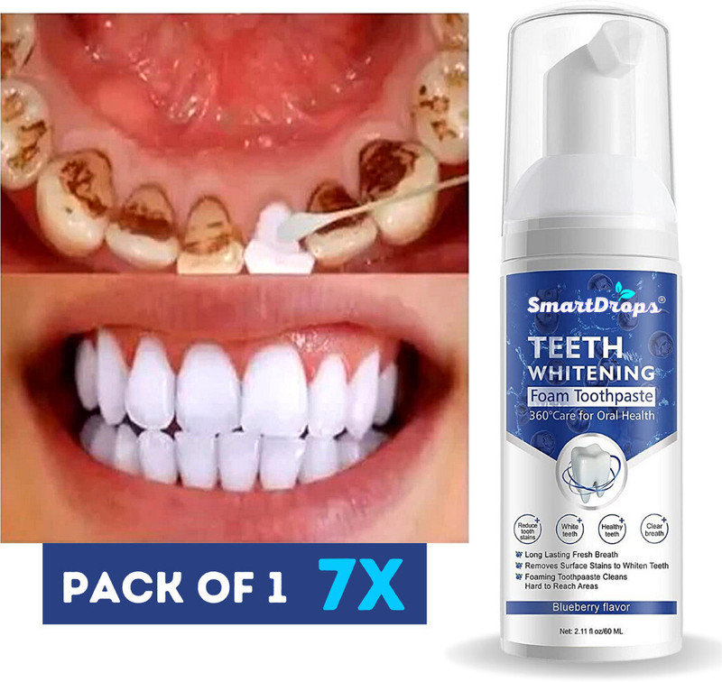 smartdrops Teeth Whitening Mousse Foam Cleaning Germs,Yellow Teeth Remove Toothpaste 60ml Teeth Whitening Kit