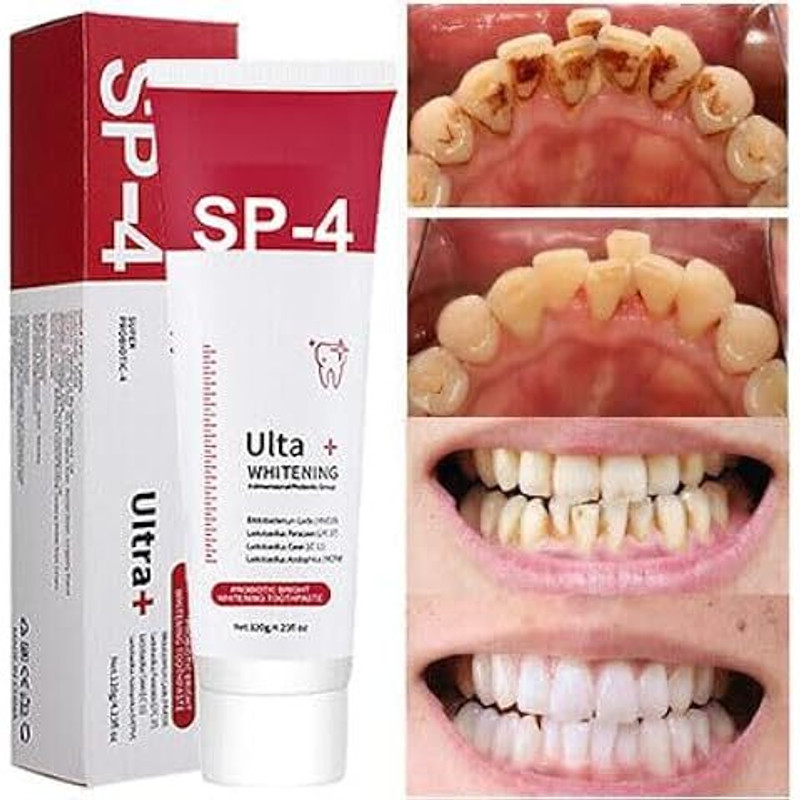 Orlisse SLS-001 Teeth Whitening Kit