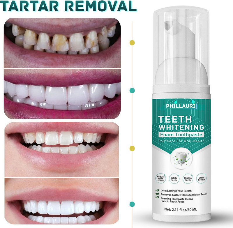 smartdrops Natural Teeth Whitening Foam To Removes Bad Breath Fights Germs Teeth Whitening Kit