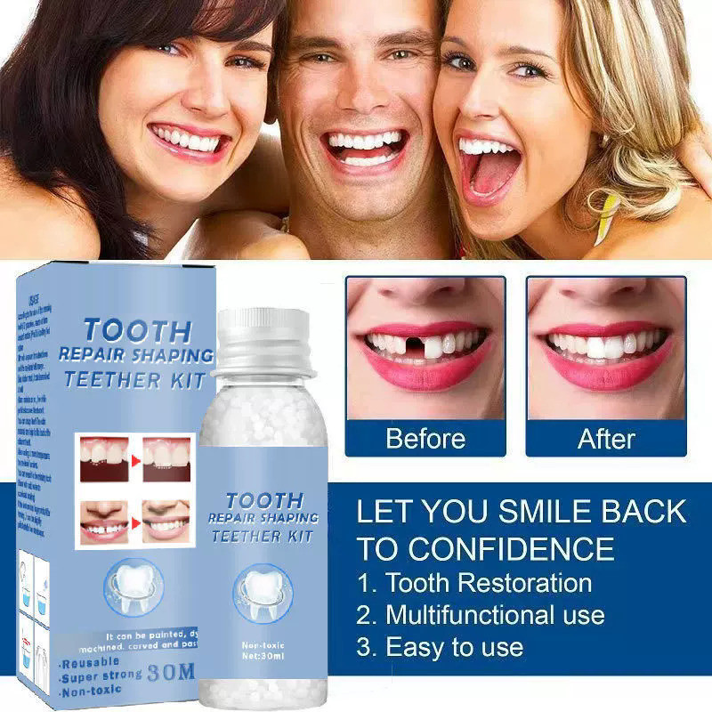 Qorelya Tooth Repair Kit for Home Temporary Replacement Teeth Whitening Kit