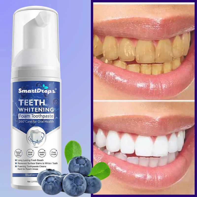 smartdrops GlowFoam Dentashine: Brilliance for Your Brightest Smile Teeth Whitening Kit
