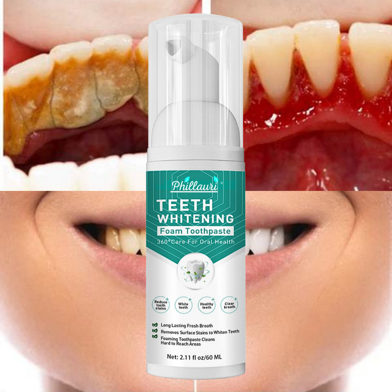 Phillauri Teeth Whitening Foam To Removes Bad Breath & Yellow Teeth Removal Teeth Whitening Kit