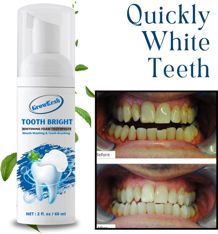 Growkesh Teeth Whitening Mousse Foam To Deeply Cleaning Gums | For Women & Men Teeth Whitening Kit